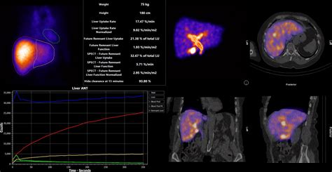 hermes 4d liver function